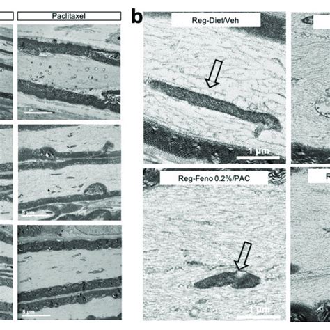 Morphological features of sciatic nerves: Transmission electron ... 