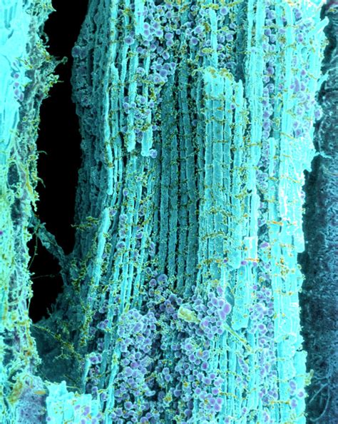 Coloured Sem Of Healthy Heart Muscle Fibres Photograph By Steve