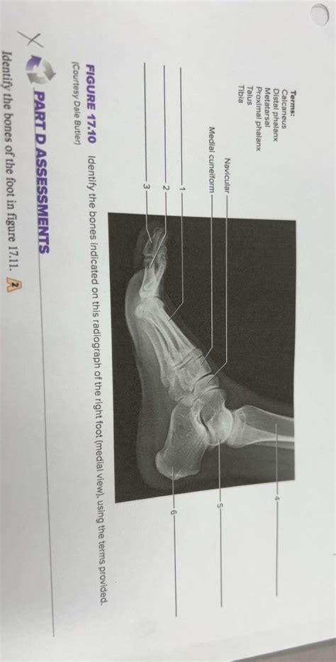 Solved Figure Identify The Bones Indicated On This Chegg