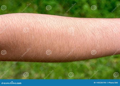 Hairy Arms Pics Telegraph