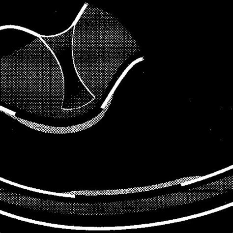 Illustration Of A Semicircular Canal Ampulla Components Of The Download Scientific Diagram