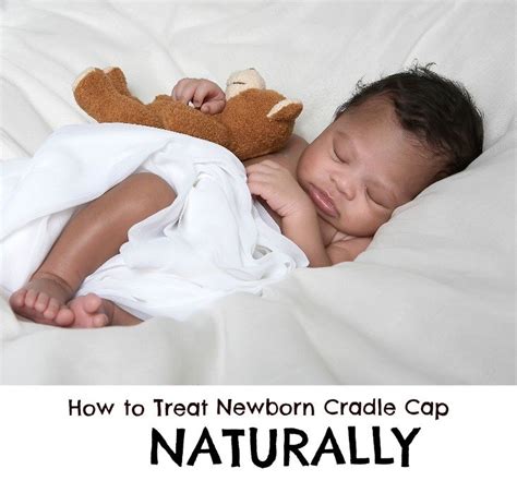 How To Use Coconut Oil To Treat Cradle Cap Rattles And Heels