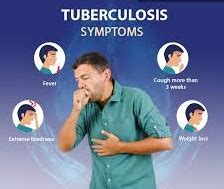 TB Signs & Symptoms - Invitroal Biotechnology