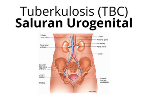 Tuberkulosis TBC Saluran Urogenital Yayasan KNCV Indonesia