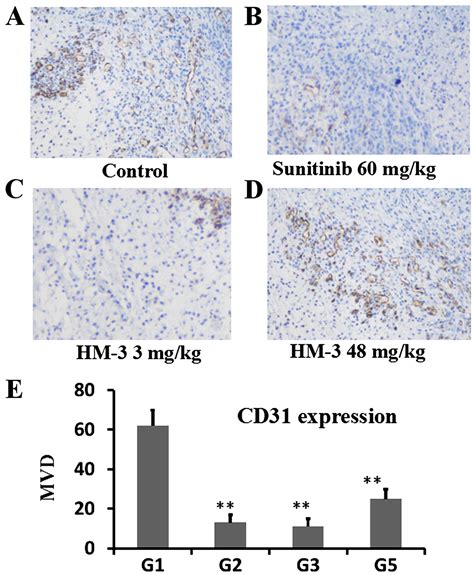 In Vitro And In Vivo Activities Of An Antitumor Peptide HM 3 A Special