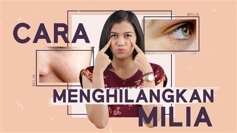 Begini Cara Menghilangkan Dan Mengatasi Milia Pada Wajah Youtube