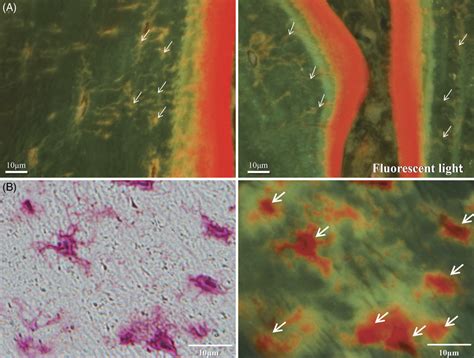 (A) Osteocyte canaliculi after total parathyroidectomy (PTX) in group... | Download Scientific ...