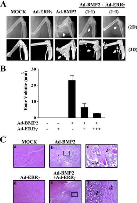 Err Inhibits Bmp Induced Ectopic Bone Formation In Vivo A