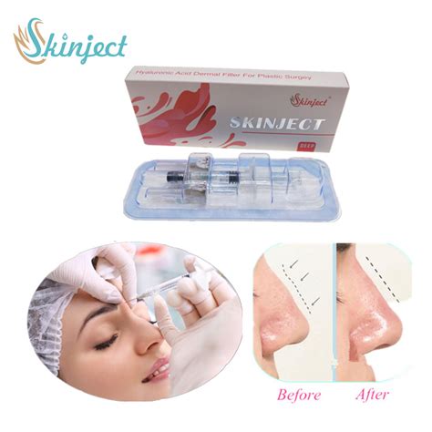 Skinject Ml Deep Hyaluronic Skin Filler Injectable Beauty Dermal