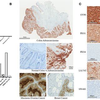 NEO 201 Binds To CEACAM 5 And 6 A To Identify The Antigen