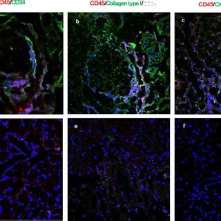 Hc Ha Ptx Suppresses Inflammatory Cell And Fibrocyte Infiltration Into