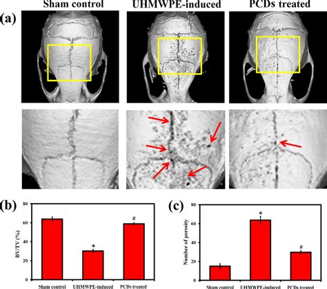 Inhibitory Potential Of PCDs In UHMWPE Induced Osteolysis In Mouse