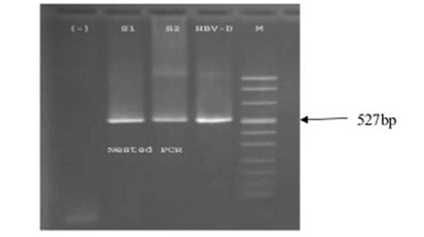 Kỹ thuật xét nghiệm pcr và ứng dụng trong chẩn đoán sinh học phân tử