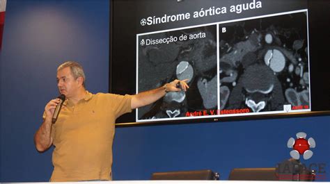 Curso De Aprimoramento Em Angiorradiologia E Cirurgia Endovascular 2015