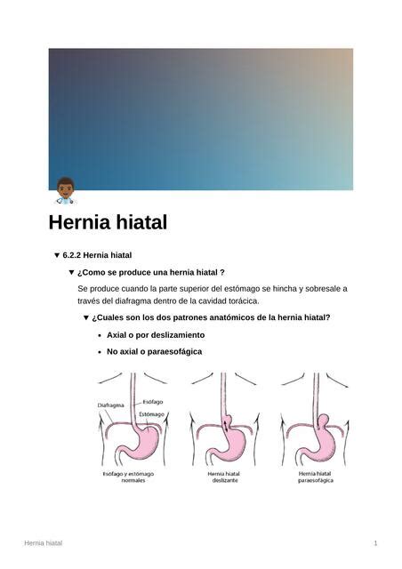 Hernia Hiatal Espm Medicina Udocz