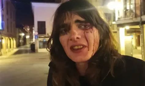 Brutal agresión transfóbica en Alcalá de Henares dos hombres golpean a