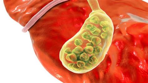 O Que Significa Bile - O que é Bile: função, pra que serve, composição - Planeta Biologia