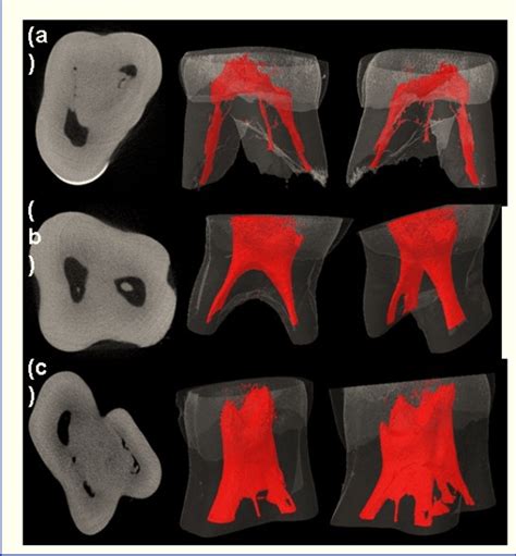 Axial Micro CT Sections And 3D Reconstructions Of Deciduous Molars A