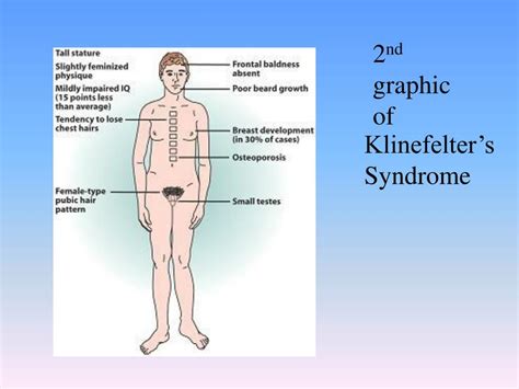 Ppt Klinefelter’s Syndrome Powerpoint Presentation Free Download Id 6730579