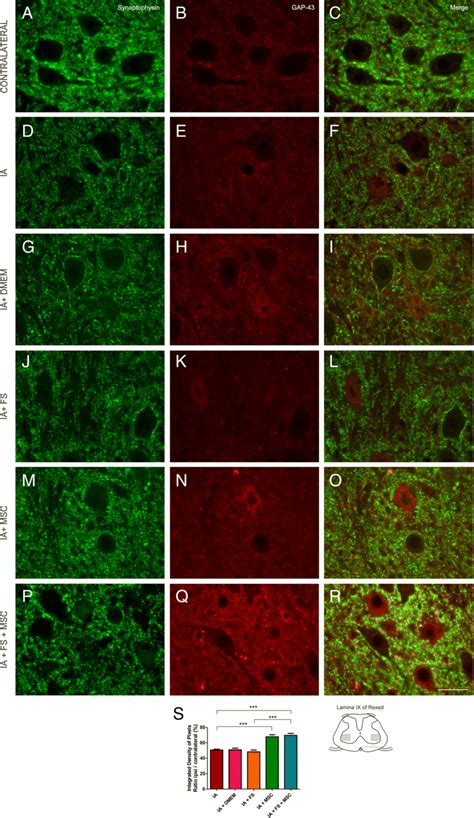 Immunohistochemical Analysis Of The Spinal Cord Lamina Ix Labeled Download Scientific Diagram