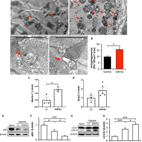 Autophagy Is Upregulated In Hypoxic Cells Treated With Icm Ex A Mice