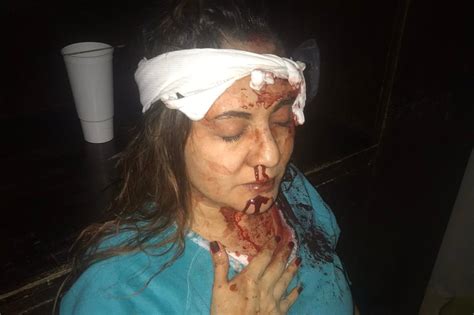 Ex Ceo Of Amazon Mexicos Wife Beaten To Pulp In Horrific Images Before Murder