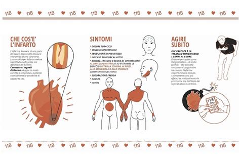 I Sintomi Dellinfarto Le Differenze Nelluomo E Nella Donna