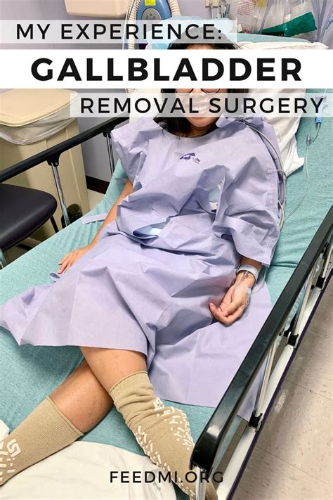 My Experience With Gallbladder Removal Surgery In 2020 Removal