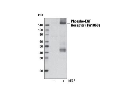 Phospho Egf Receptor Tyr D A Xp Rabbit Mab Biotinylated