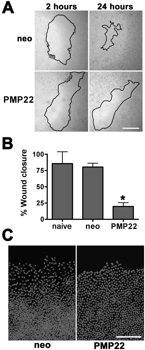 PMP22 Alters Wound Healing By Epithelial Monolayers A Confluent