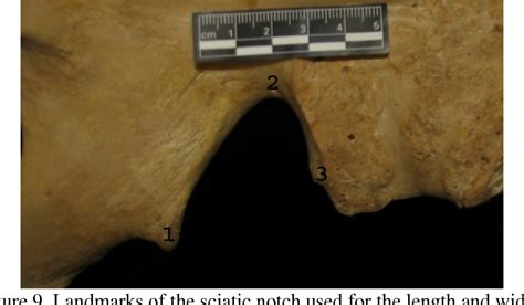 Figure 7 From Sexual Dimorphism Of The Posterior Pelvis Of The Robert J