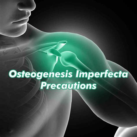 Osteogenesis Imperfecta Treatment