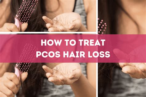 How to Treat PCOS Hair Loss: 7 Tips to Try at Home - PCOS Mag