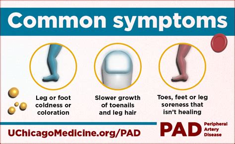 Peripheral Artery Disease Symptoms Causes And Treatments Uchicago