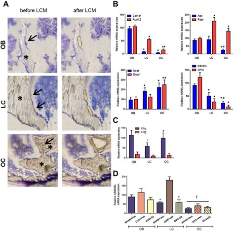 In Situ Mrna Profiling Of Bone Cells In Cryosections By Laser Capture