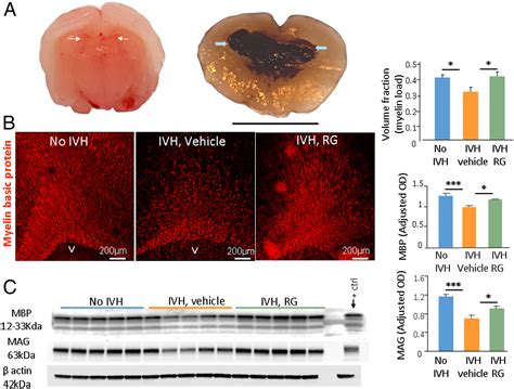 Rodent Neonatal Germinal Matrix Hemorrhage Mimics The Human 46 Off