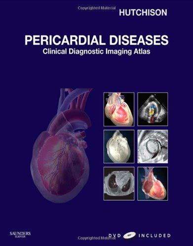 Amazon Pericardial Diseases Clinical Diagnostic Imaging Atlas With