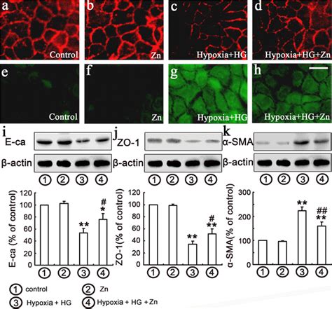 Effect Of ZN On HG Hypoxia Induced EMT Markers In NRK 52E Cells Ac