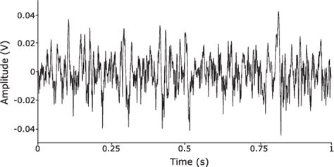 Figure From Deep Learning For Robust Decomposition Of High Density