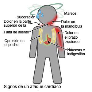 Ataque Card Aco Care Guide Information En Espanol