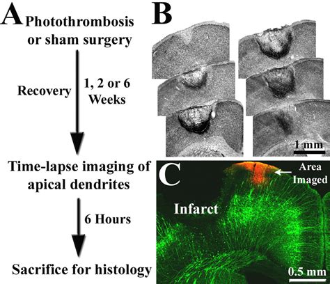 Extensive Turnover Of Dendritic Spines And Vascular Remodeling In