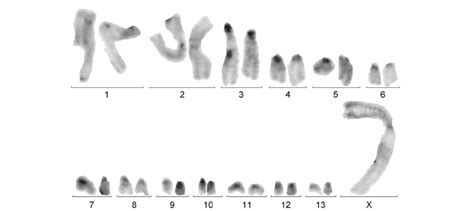 Caryotype En Bandes C De Saga Campbelli Mâle C Banded Male Karyotype