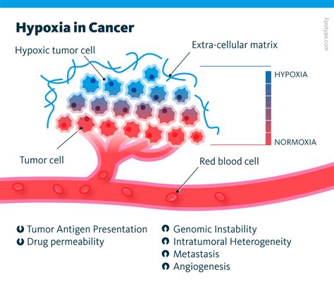 Lipid Metabolism In Hypoxic Cancer Lipidomics Analysis Lipotype GmbH