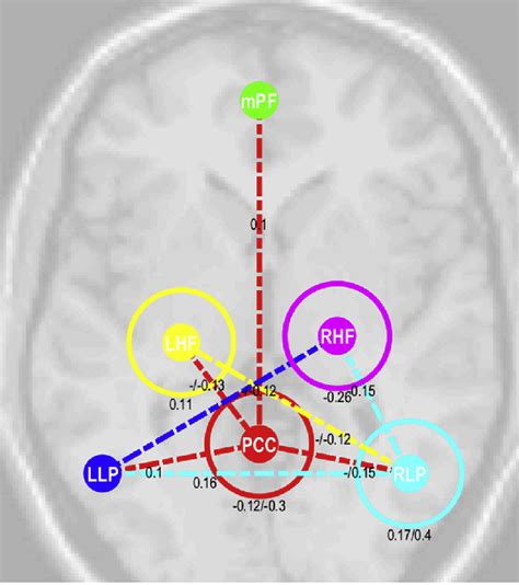 Connections In The Default Mode Network Of Healthy Controls For Which Download Scientific