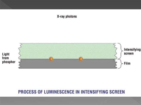 Intensifying Screen X Ray Ppt