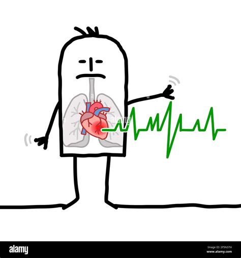 Heart failure cartoon hi-res stock photography and images - Alamy