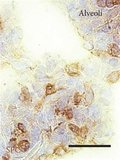 Composition Of Epithelial Cell Types In Conducting Airway Epithelium Of Download Scientific