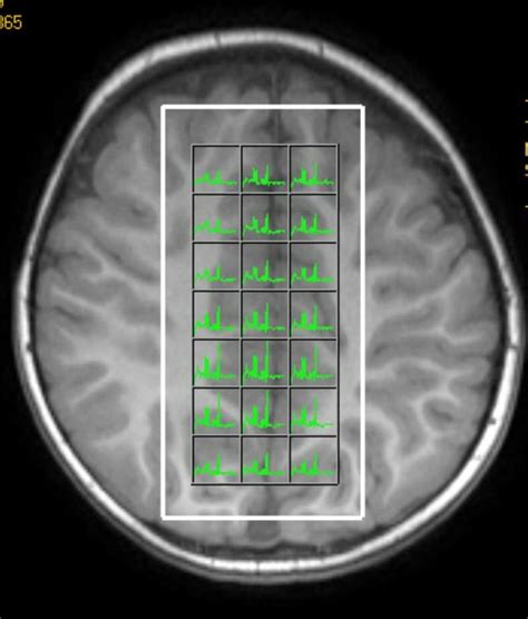 Magnetism Questions And Answers In MRI