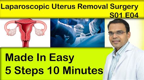 Laparoscopic Uterus Removal Surgery S01 E04 Made In Easy 5 Steps 10