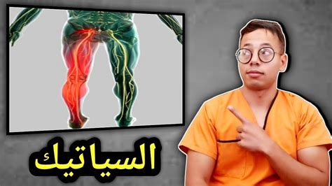 السياتيك عرق النسا أسبابه، أعراضه وعلاجه هاعلاش مازال مبرتيش